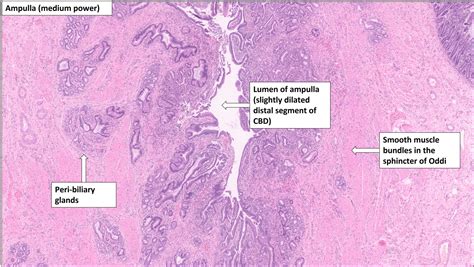 Sphincter Of Oddi Histology - what triggers sphincter of oddi pain