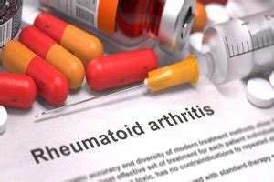 Vagus nerve stimulation may be novel treatment of rheumatoid arthritis