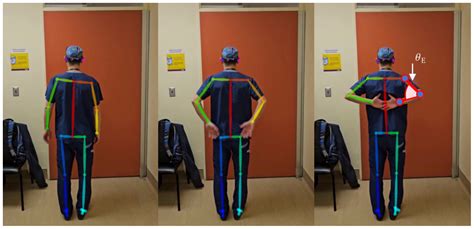 Automated Assessment of Upper Extremity Function with the Modified ...
