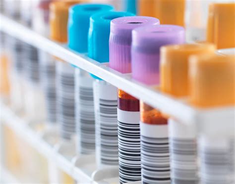 Insulin C-peptide test