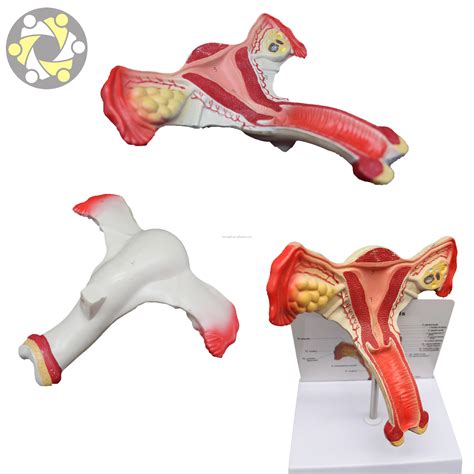 Lonningift Female Reproduction Model - Pathological Anatomy