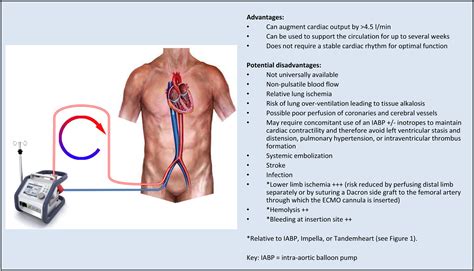 Percutaneous Circulatory Assist Devices for High-Risk Coronary ...
