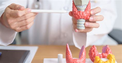Hypothyroidism (Underactive Thyroid): Everything You Need to Know ...