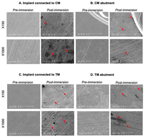 Surface Corrosion from Implant–Abutment Couplings with Different ...