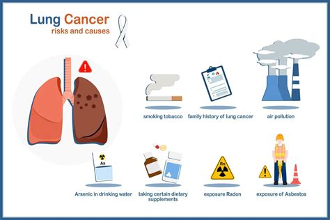 Causes and risk factors that cause lung cancer,medical vector illustrations about causes of lung ...