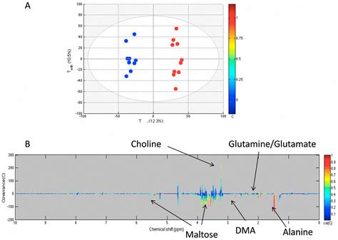 Metabolomics with Nuclear Magnetic Resonance Spectroscopy in a ...