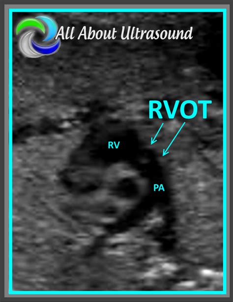 5 Best Practice Tips to OB GYN Ultrasound