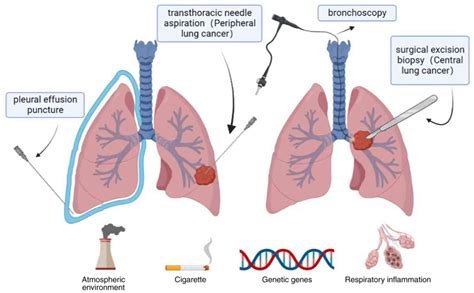 Dual inhibition of EGFR‑VEGF: An effective approach to the treatment of advanced non‑small cell ...
