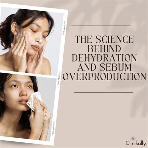 Dehydration & Oily Skin: The Surprising Summer Link | Clinikally