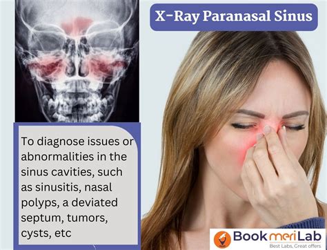 X Ray PNS Price - Book Online at Top Radiology Centers