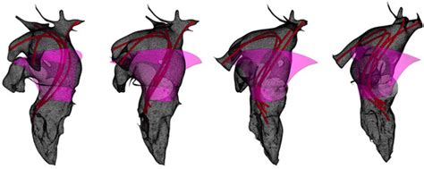 A New Approach to the Parameterization of Streamlined Surfaces of the ...