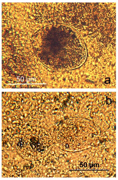 Severe Parasite Co-Infection in a Captive Bactrian Camel: Case Report