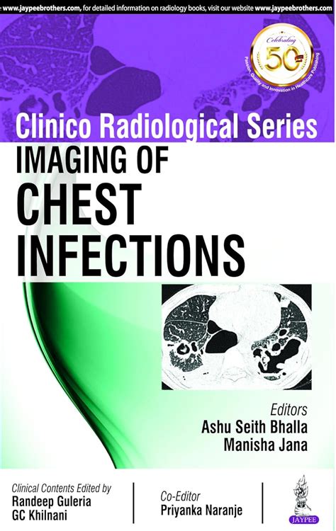 Buy Clinico Radiological Series: Imaging of Chest Infections Book ...