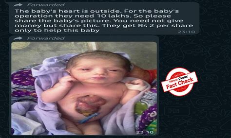 Fact Check: Old news of baby girl born with rare congenital heart ...