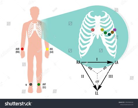 1,075 Ecg Leads Images, Stock Photos & Vectors | Shutterstock