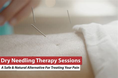 Dry Needling Therapy Sessions - Advanced Sports & Family Chiropractic ...