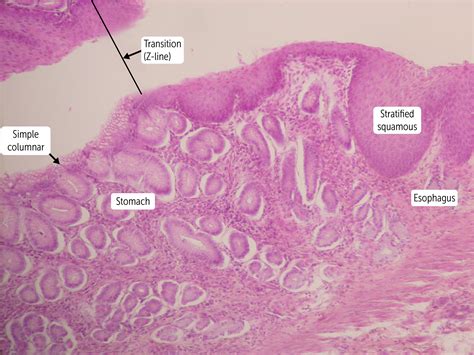Lower Esophageal Sphincter Histology