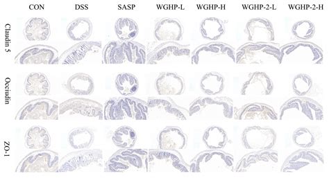 Structural Characterization of an Acidic Polysaccharide from Walnut ...
