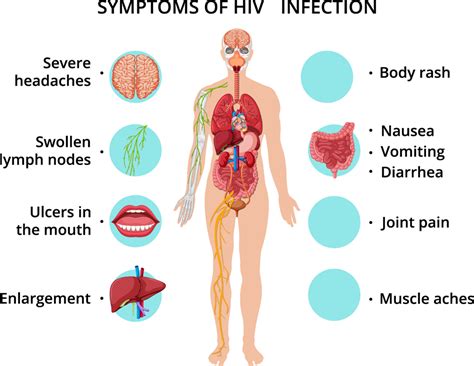 Symptoms, treatment and prevention of AIDS — lesson. Science State ...