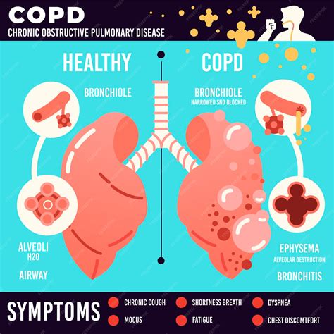 Chronic Obstructive Pulmonary Disease