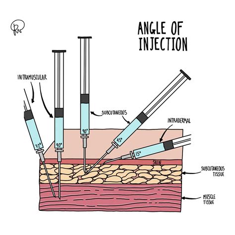 Injection Back Side 的图像结果