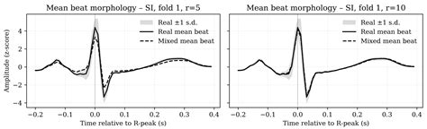 Evaluation of Data Augmentation Under Label Scarcity for ECG-Based ...