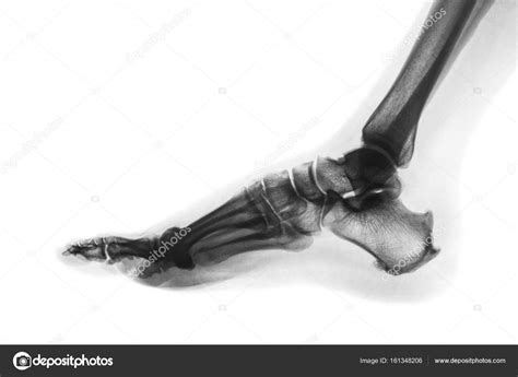 Normal Lateral Foot Xray