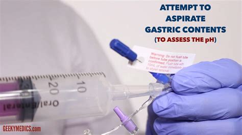 How To Measure Length Of Ng Tube at David Prather blog