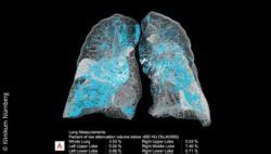 AI in imaging: how machines manage our Big Data