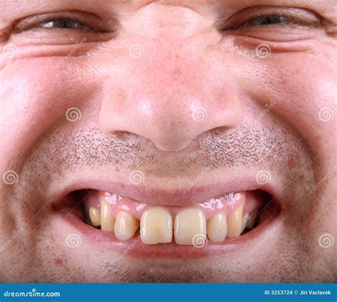 Ugly Man Stock Images - Image: 3253724