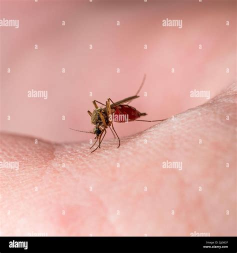 Dangerous Zika Infected Mosquito Skin Bite. Leishmaniasis, Encephalitis, Yellow Fever, Dengue ...