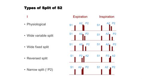 2 nd heart sound S2.pptx