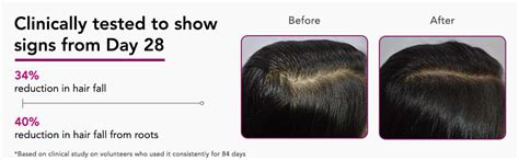 Buy Bontress PRO+ Scalp Serum Fortified with Redensyl, Anagain, Capixyl ...