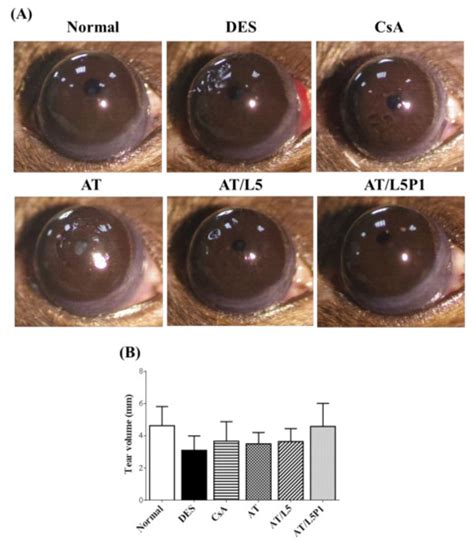 Development of Lutein-Containing Eye Drops for the Treatment of Dry Eye ...