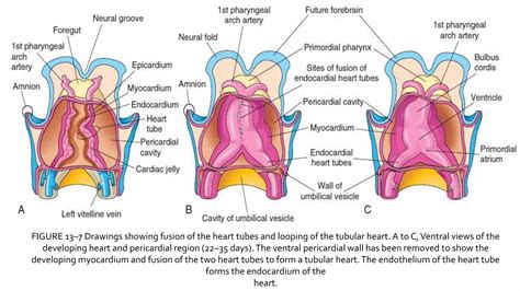 Mechanism Of Congenital Malformation Of The Heart
