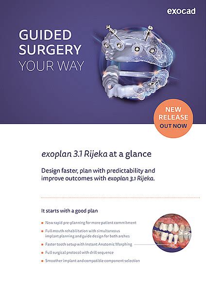 Exoplan Tutorial 的图像结果