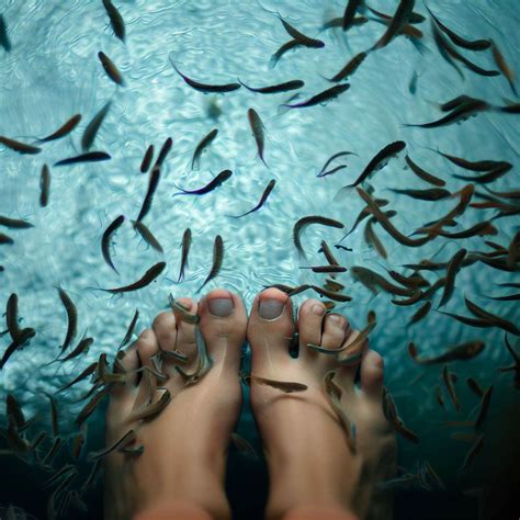 Fish Who Eat Dead Skin - Petsago