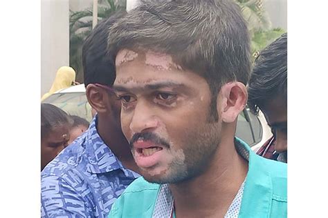 5th case of broken needle left in patient