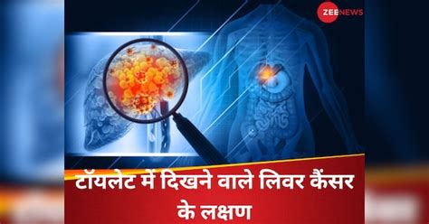 5 early symptoms of liver cancer| liver cancer symptoms stage 1| liver ...