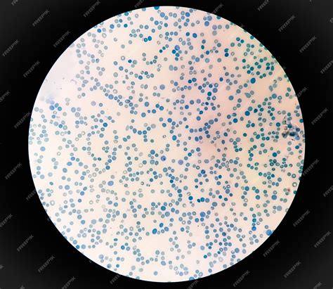 Premium Photo | Close view of reticulocyte count under microscope methylene blue staining