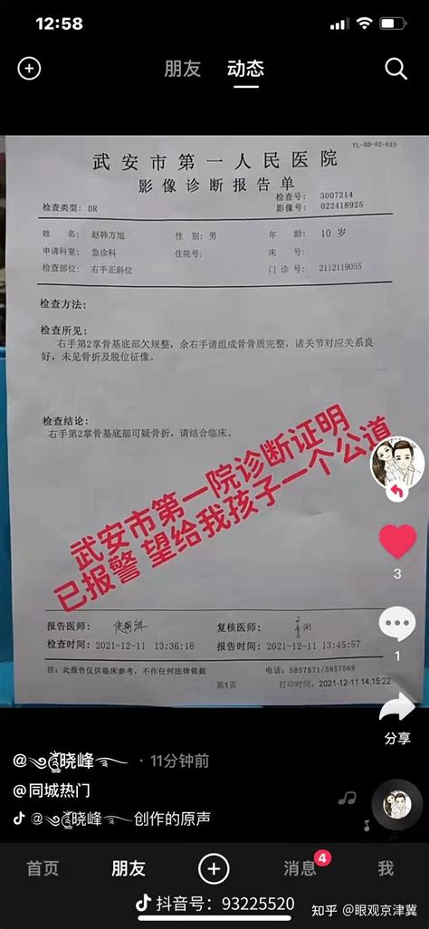 河北邯郸:武安市向阳小学学生手指被打骨折，武安市教育局领导玩“躲猫猫” - 知乎
