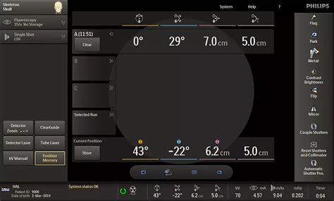 Philips - Veradius Unity - Circular Edition - Refurbished Mobile C-arm ...