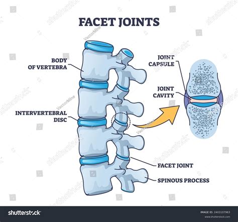 Facet Joint Growth at John Rosado blog