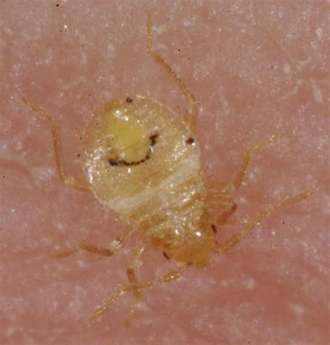 What Does Bed Bug Babies Look Like at Nicole Holcomb blog