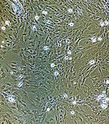 胶质细胞 的图像结果
