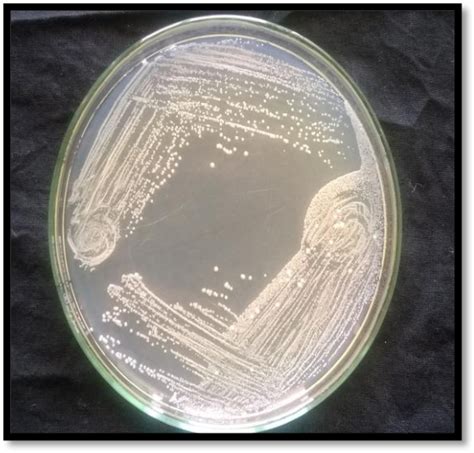 Image result for Enterococcus Faecalis MSA Plate