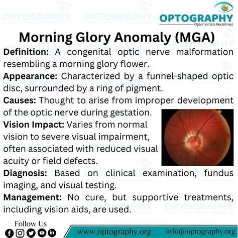 Morning glory disc anomaly: a birth defect | OPTOGRAPHY posted on the topic | LinkedIn