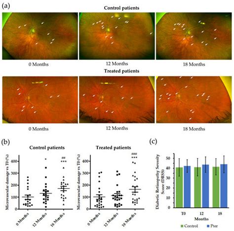 Potential of Pterostilbene as an Antioxidant Therapy for Delaying ...