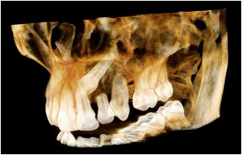Dentoview - Advanced Dental Imaging