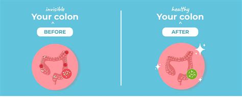 Velbiom Eukolon for Boosting Colon Health Improves Gut Health Refreshes ...